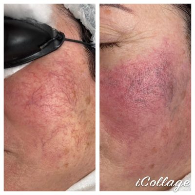 skinbar-kozmetika-elektrokozmetika-alakformalas-dioda-lezeres-kezelesek-dabas-hajszaler-kezeles-02