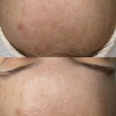 skinbar-kozmetika-elektrokozmetika-alakformalas-dioda-lezeres-kezelesek-dabas-oxygeneo-04
