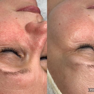 skinbar-kozmetika-elektrokozmetika-alakformalas-dioda-lezeres-kezelesek-dabas-oxygeneo-07
