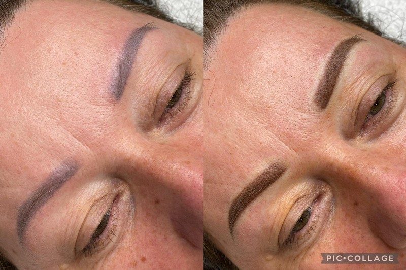 skinbar-kozmetika-elektrokozmetika-alakformalas-dioda-lezeres-kezelesek-dabas-sminktetovalas-65