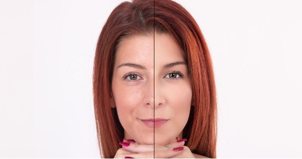 skinbar-kozmetika-elektrokozmetika-alakformalas-dioda-lezeres-kezelesek-dabas-113